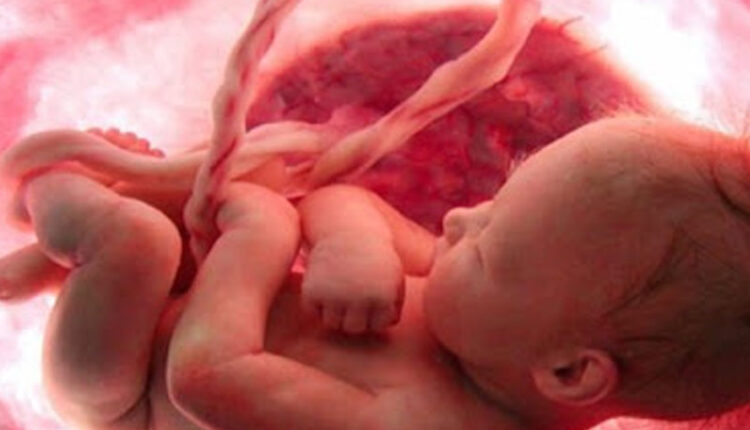 10موردی که ممکن است شما را در مورد بارداری غافلگیر کند!