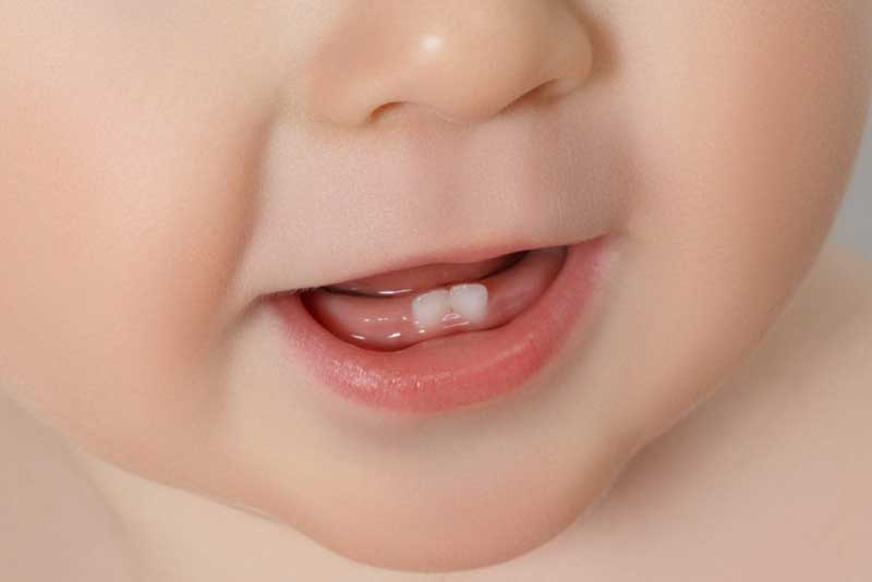 دهان کودک‌تان را قبل از درآمدن دندان­‌ها، تمیز کنید