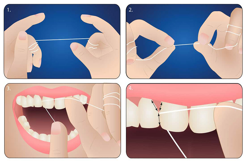 استفاده از نخ دندان: مراحلی که باید دنبال کنید؟