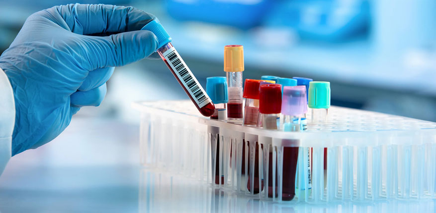 خواندن آزمایش خون