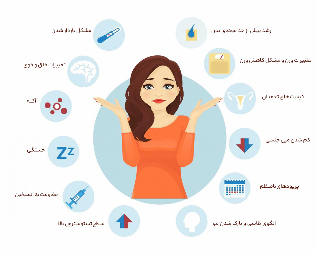 علائم تخمدان پلی کیستیک