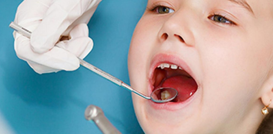 تفاوت پالپوتومی و پالپکتومی
