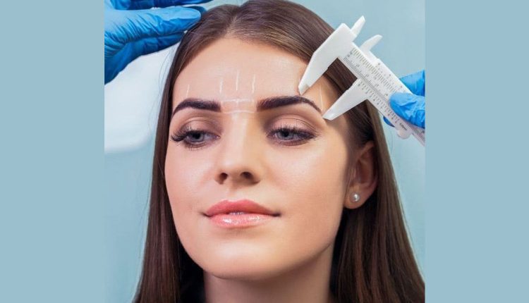 کاشت مو رشت