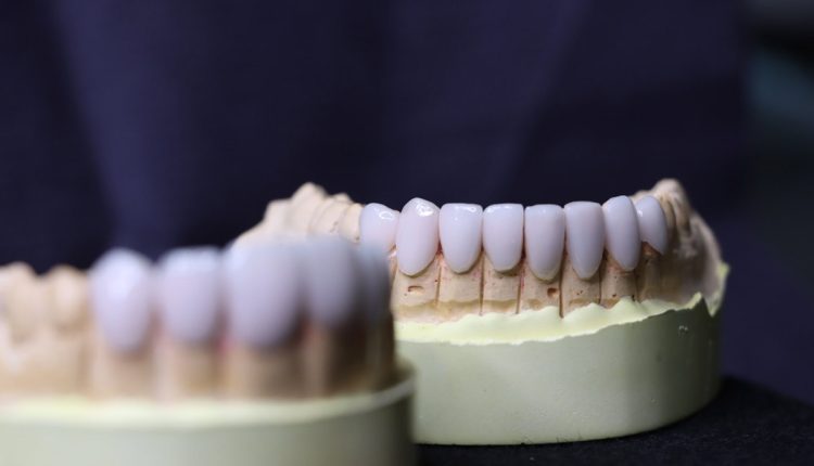 لمینت دندان از دَم قسط