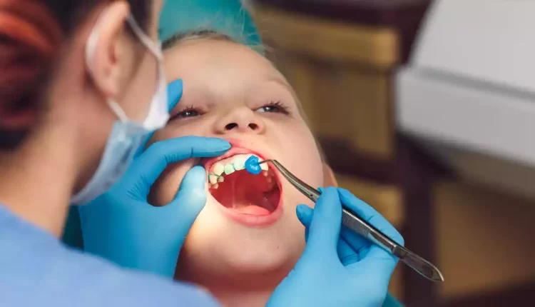 فلوراید تراپی